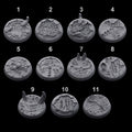 Alien Infested Bases - 32mm