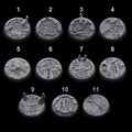 Alien Infested Toppers - 32mm